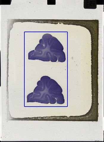 Media type: image; Special Collections 3043   shows specimen_part histological serial section;